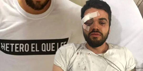 Homoseksual idmançını vəhşicəsinə döyüldü - FOTO 