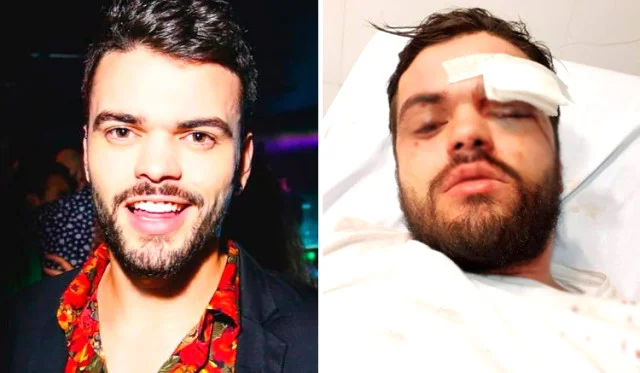 Homoseksual idmançını vəhşicəsinə döyüldü - FOTO 