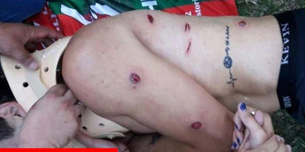 Polis plastik mərmilərlə futbolçuları vurdu - FOTOLAR 
