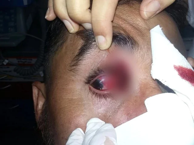 Polis plastik mərmilərlə futbolçuları vurdu - FOTOLAR 