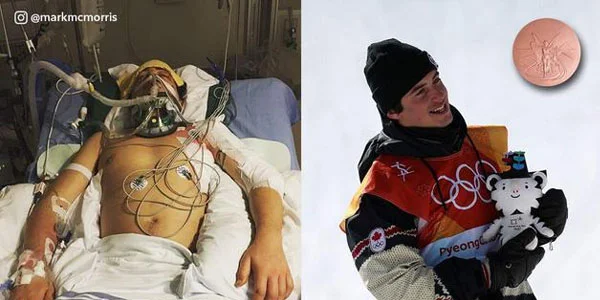 Bir il əvvəl komada idi, indi dünya ondan danışır - FOTO 
