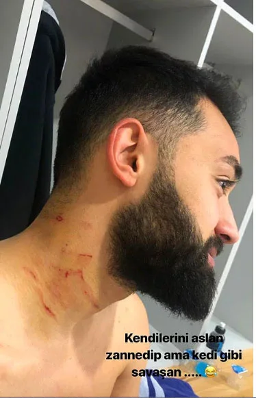 Futbolçu oyun zamanı ülgüclə rəqiblərinə xəsarət yetirdi - FOTO/VİDEO 