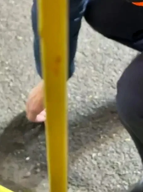 Futbol matçında faciə: Qola sevinərkən barmağını qopardı - FOTO/VİDEO 