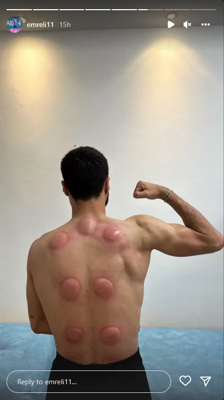 Emreli özünü Benzemaya oxşatdı - FOTO 