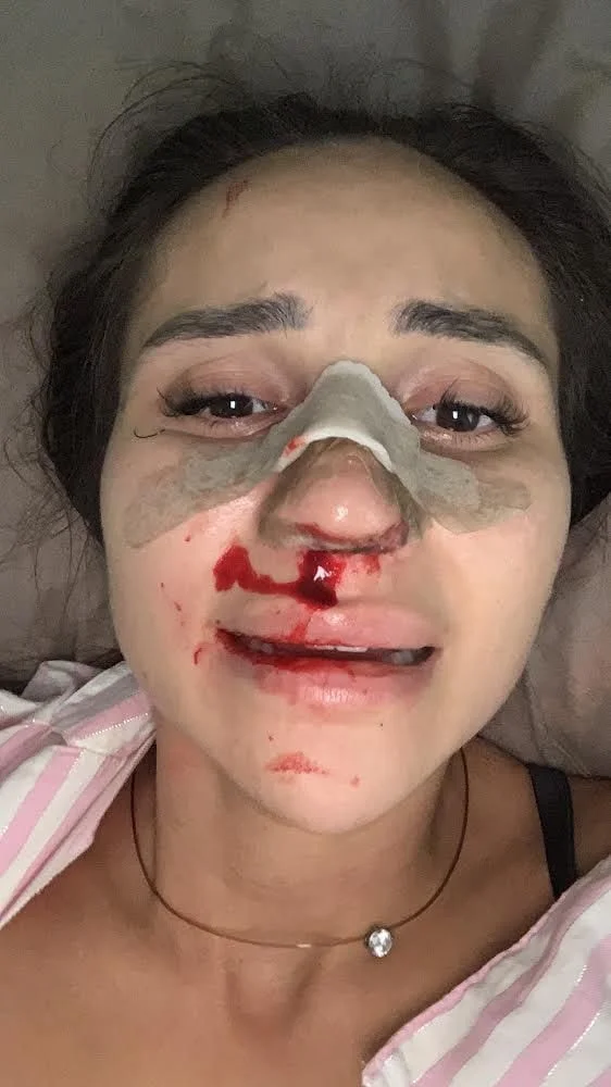 Gürcü hücumçu sevgilisini döyüb bu hala saldı - FOTO 