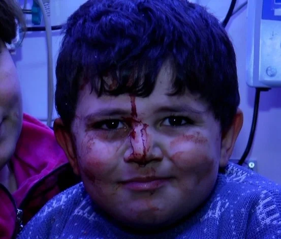 Qurban Qurbanov Gəncədə erməni terroru qurbanlarının xatirəsini yad etdi - FOTOLAR 