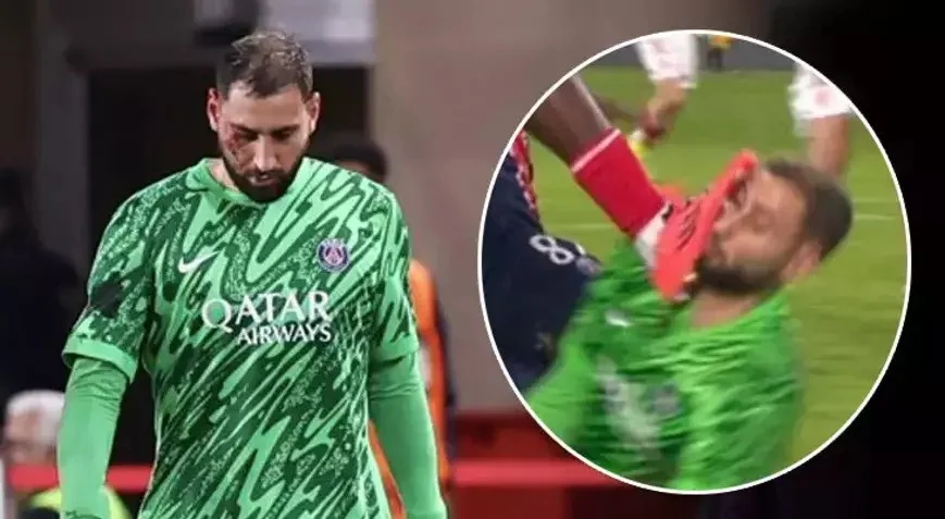 PSJ qələbə qazandı, Donnarumma meydanı qan içində tərk etdi - FOTO 