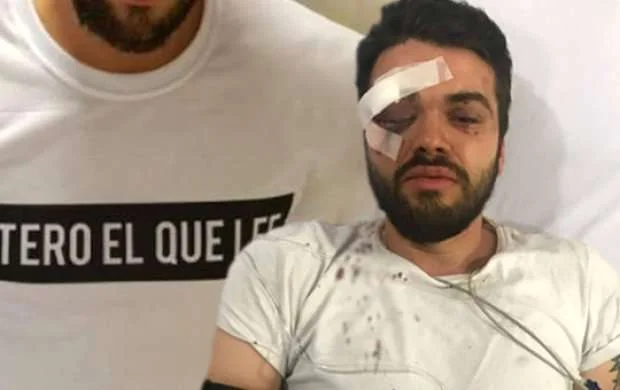 Homoseksual idmançını vəhşicəsinə döyüldü - FOTO 