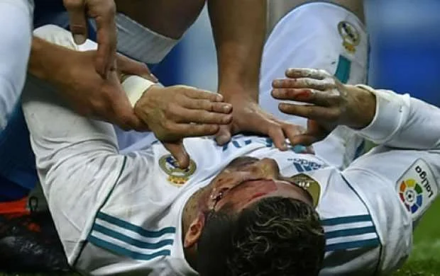 Ronaldo qan içində qaldı 
