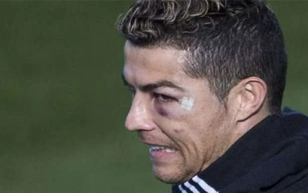Ronaldo tanınmaz hala düşdü - FOTO 