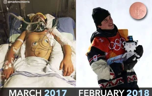 Bir il əvvəl komada idi, indi dünya ondan danışır - FOTO 