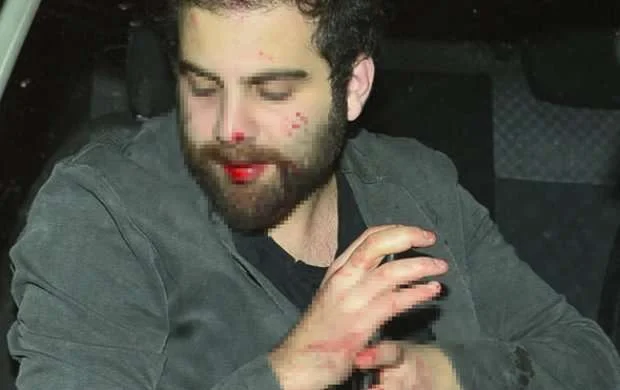 Oğuz Çətinin oğlunun başında şüşə sındırdılar - FOTOLAR 
