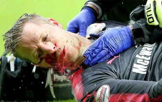 Futbolçu meydanda qana boyandı - FOTOLAR 