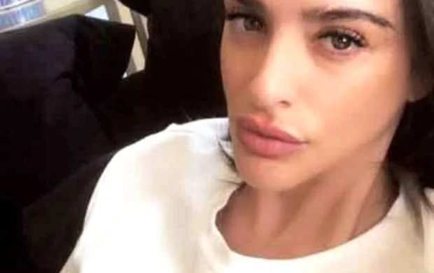 Ardanın arvadı estetik etdirdi, gülüş hədəfinə çevirildi - FOTO 