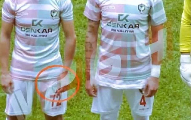 Futbolçu oyun zamanı ülgüclə rəqiblərinə xəsarət yetirdi - FOTO/VİDEO 