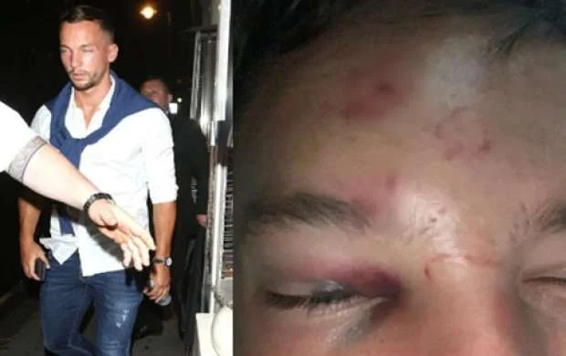 Sərxoş oldu, həmkarının sevgilisini evinə aparmaq istədi, vəhşicəsinə döyüldü 