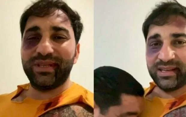 Kamil Zeynallının yayılan fotosuna aydınlıq gətirildi - VİDEO 