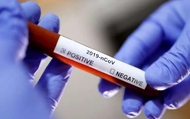 Azərbaycan klublarında koronavirus testlərinə başlanıldı 