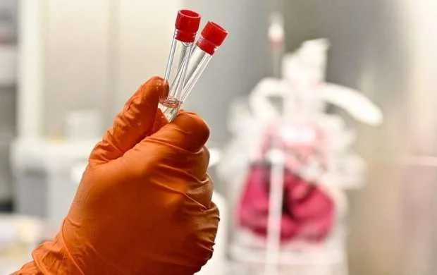 Fransa klublarında koronavirus şoku 