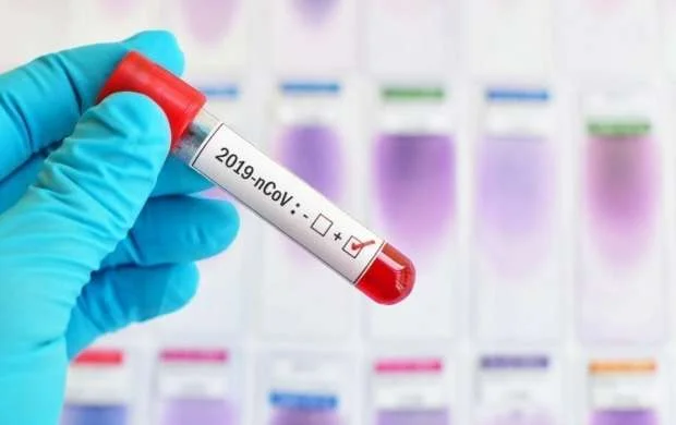Rusiya klubunda koronavirus şoku: 12 futbolçu yoluxdu 