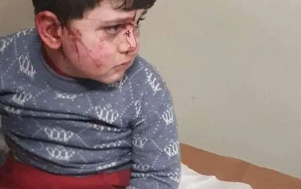 Düşmən Gəncəyə raket atıb, 5 dinc sakin ölüb, 28 yaralı var 