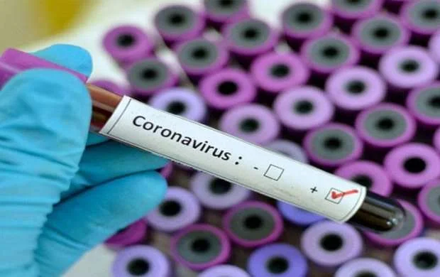 Azərbaycanda koronavirusa yoluxanların sayı 1000-i keçdi 