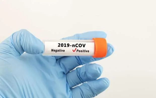 Koronavirus statistikası: Yoluxanların sayı azalmır 