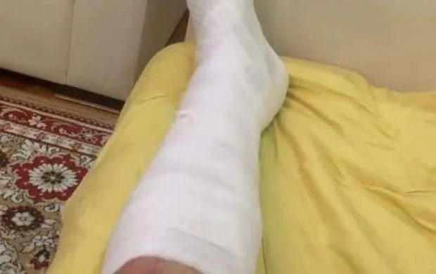 Azərbaycanlı müğənni futbol oynadı, ayağını sındırdı - FOTO/VİDEO 