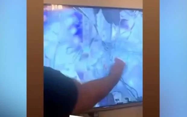 Azərbaycanlı idmançıya görə televizorun monitorunu sındırdı - VİDEO 