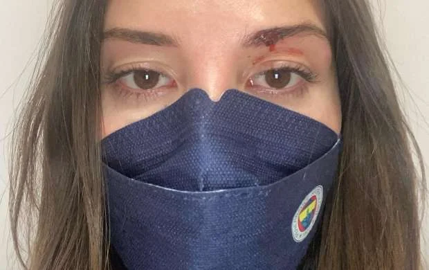 Futbolçu həyat yoldaşını döyüb bu hala saldı - FOTOLAR 