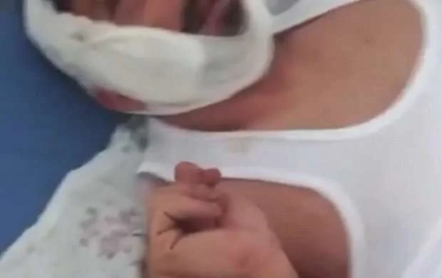 Gecə klubundakı partlayışda ağır yaralanan Azərbaycan çempionu kimdir? - FOTO 