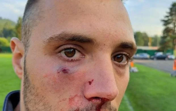 Futbol matçında dava: rəqib futbolçunu bu hala saldılar - FOTO/VİDEO 