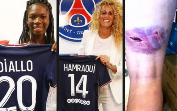 PSJ-nin futbolçusunu komanda yoldaşı döydürüb 