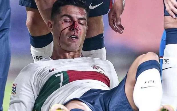 Ronaldunu zədələyən qapıçı nə danışdı? 