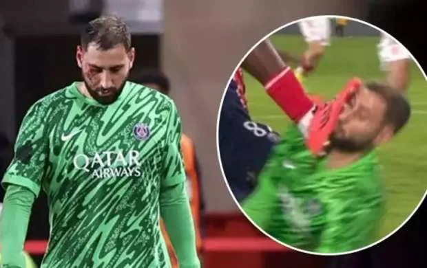 PSJ qələbə qazandı, Donnarumma meydanı qan içində tərk etdi - FOTO 